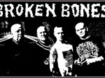 Broken Bones artist photo